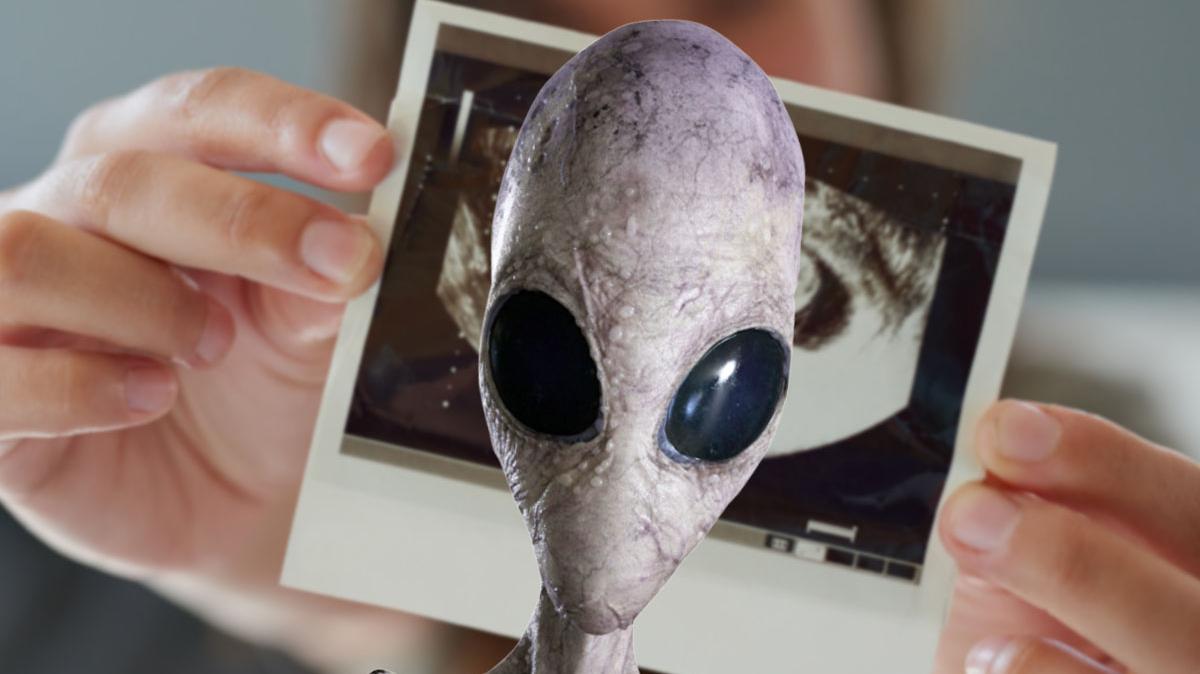 Pregnant Woman Notices An "Alien Face" In Her Baby Scan