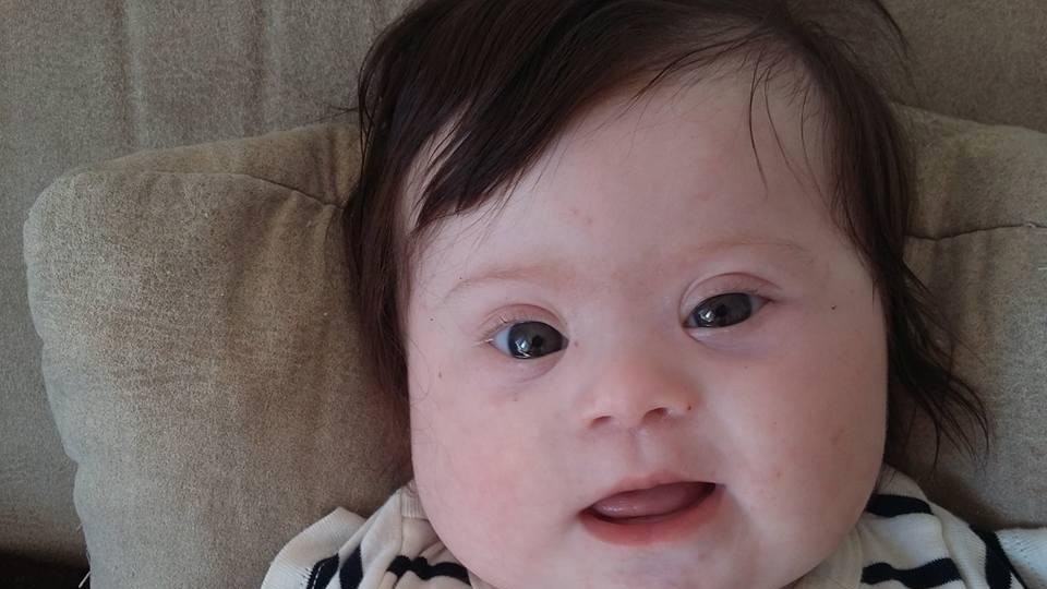 Mother Of Down�s Syndrome Baby Reveals The Insensitive