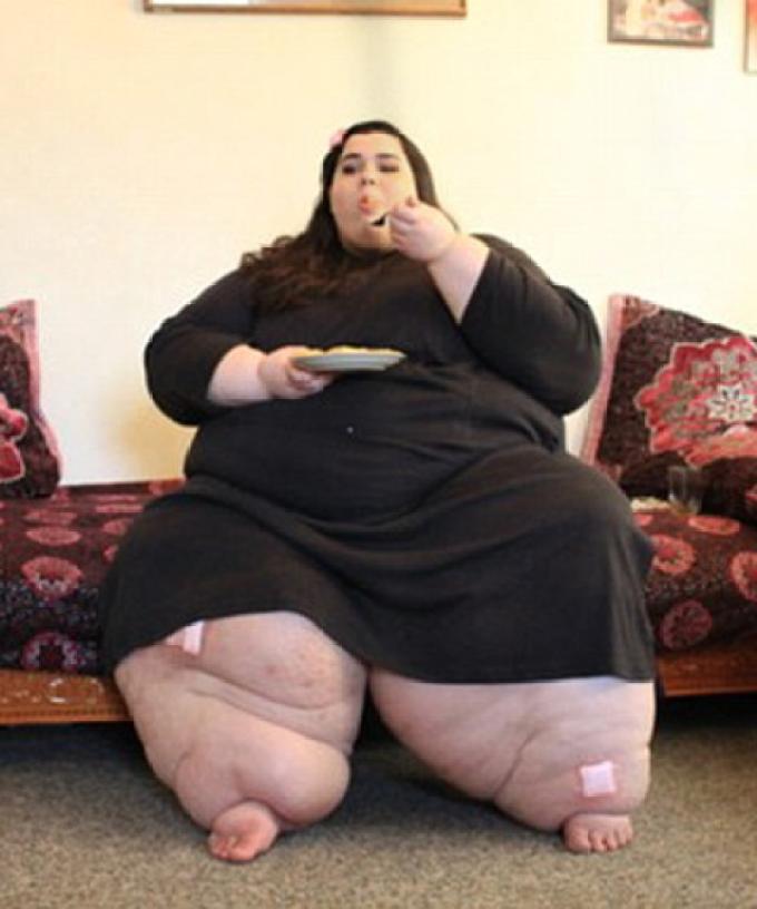Obese women morbidly Extreme Obesity,