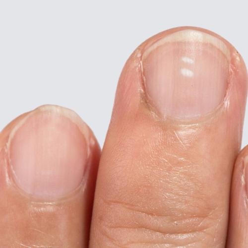We Know What Little White Dots On Your Nails Really Mean