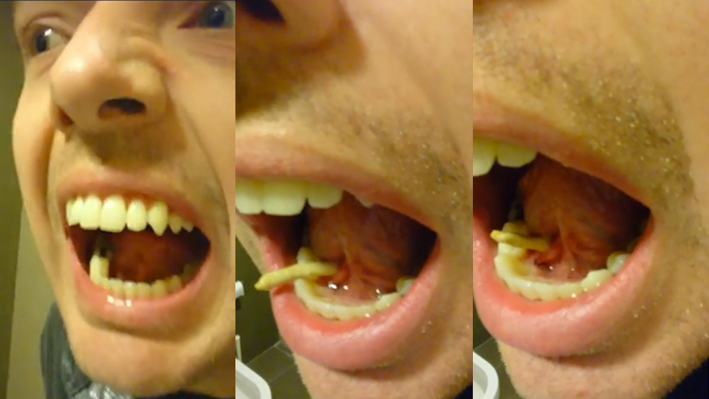 What This Man Pushes Out His Mouth Will Turn Your Stomach