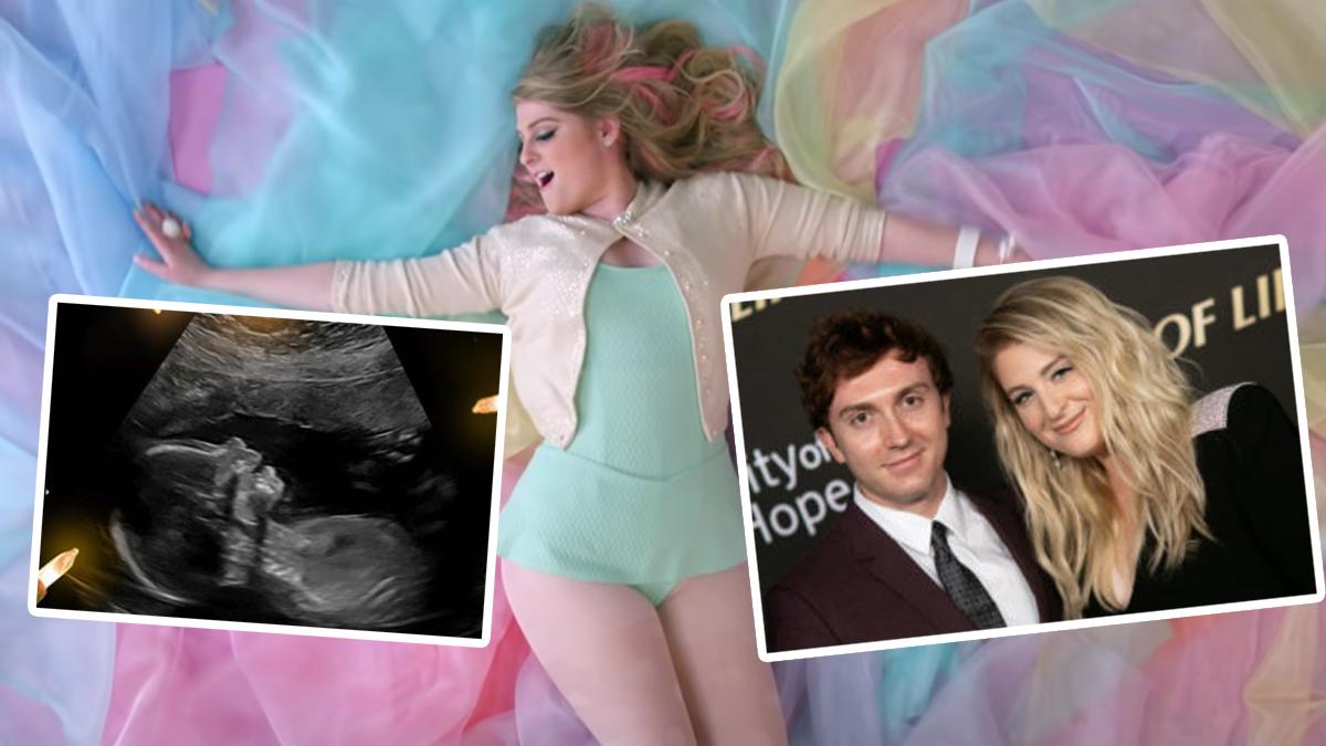 Live Sydney Meghan Trainor Is Pregnant! Also Did You Know She's Married To A Spy Kid?!