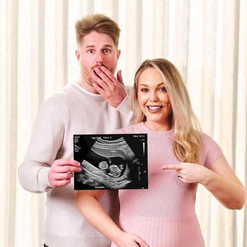 MAFS Bryce Ruthven & Melissa Rawson Reveals Surprising Amount Of Twins In Their Families