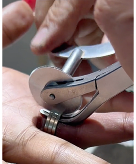 Her Rings Were Stuck For 15 Whole Years!