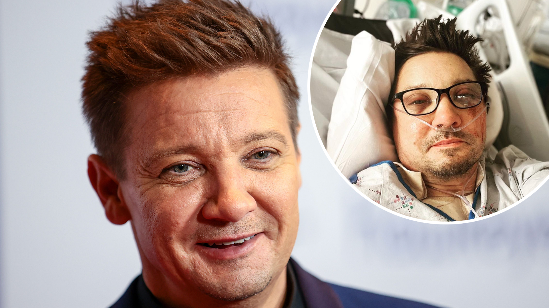 jeremy renner plastic surgery Image 7
